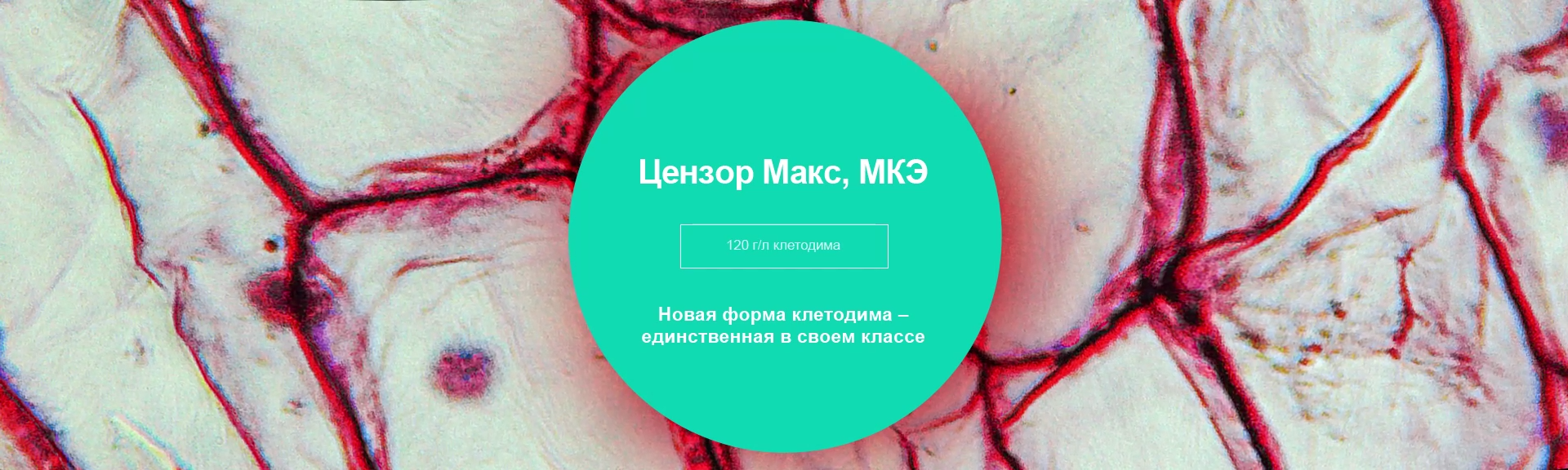Цензор Макс, МКЭ